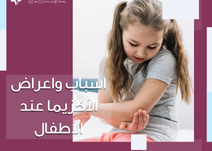 اسباب واعراض الأكزيما عند الأطفال