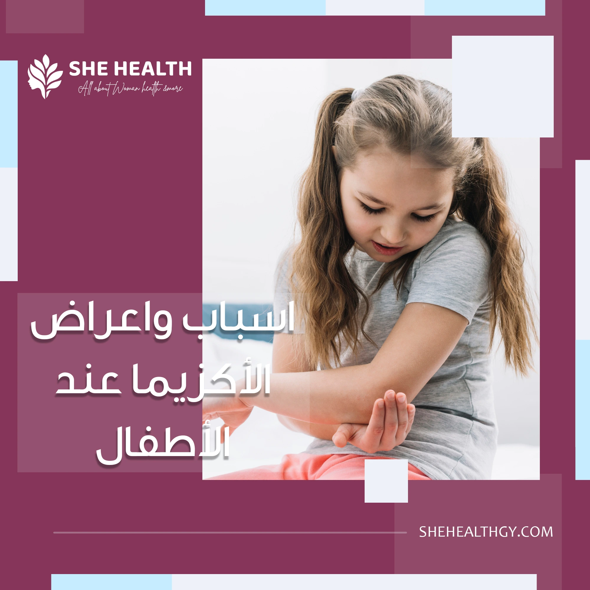 اسباب واعراض الأكزيما عند الأطفال