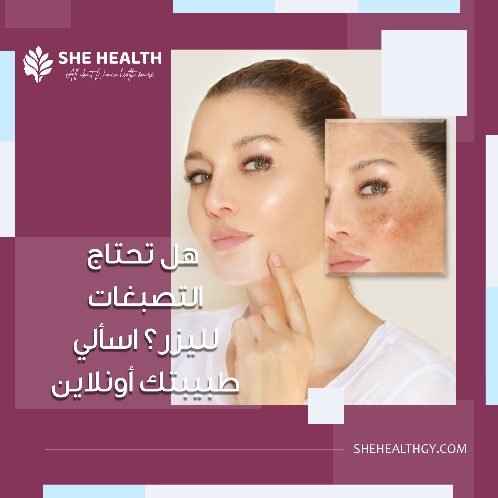 هل تحتاج التصبغات لليزر؟ اسألي طبيبتك أونلاين
